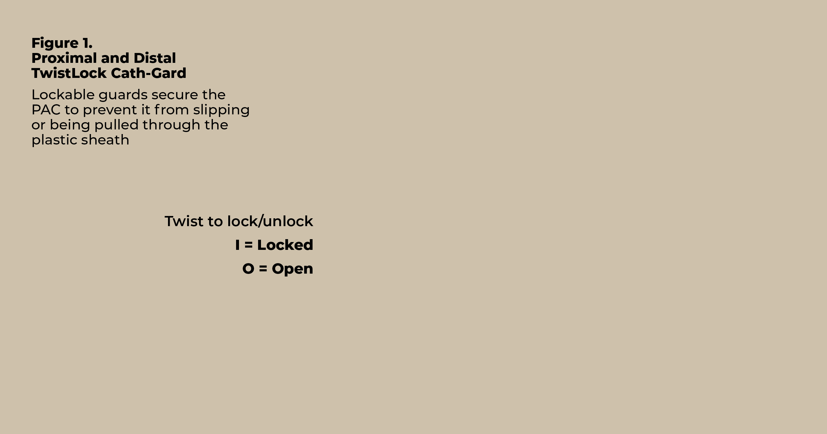 Twist to lock unlock I   Locked O   Open,Figure 1  Proximal and Distal TwistLock Cath-Gard Lockable guards secure the   
