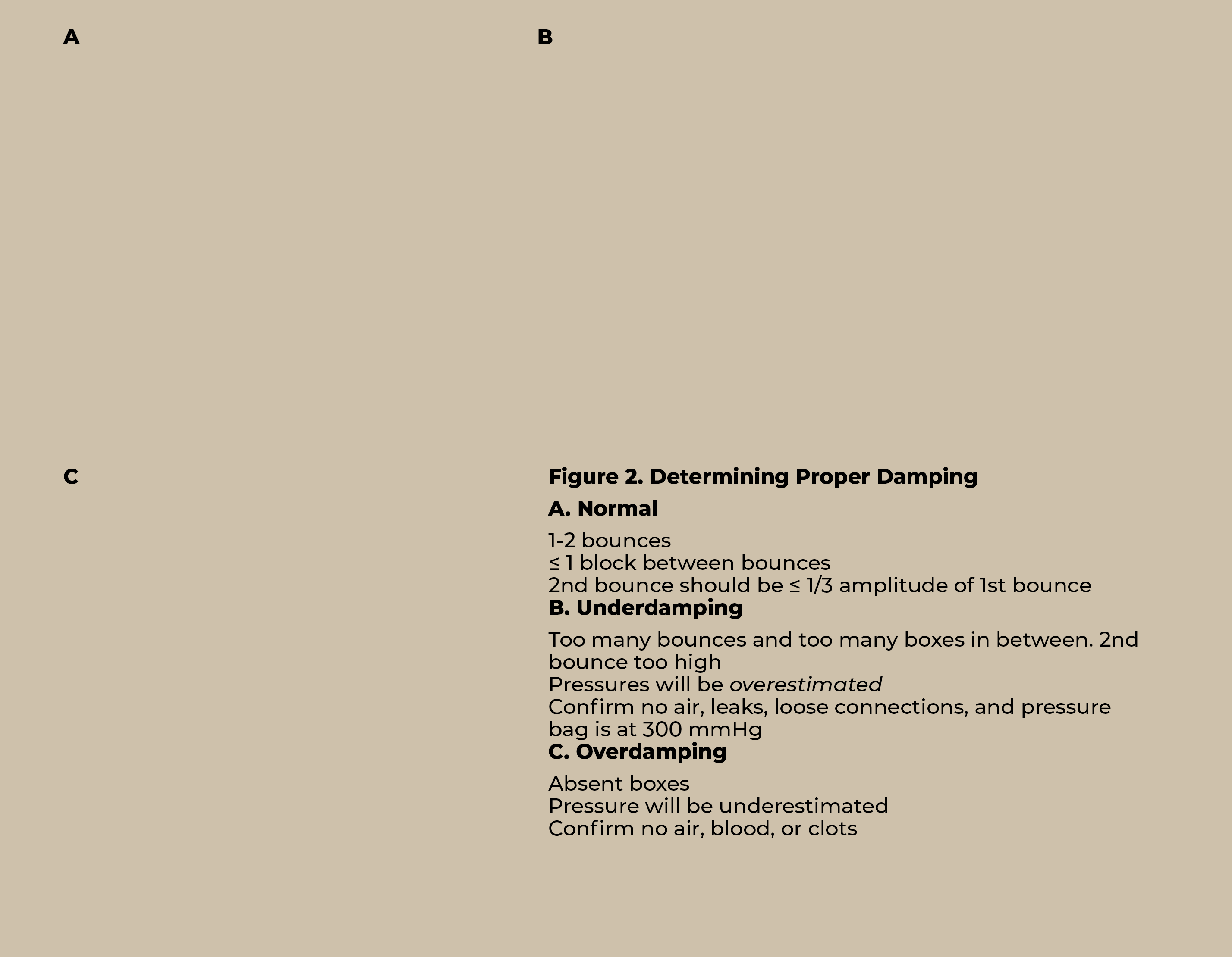 C,B,A,Figure 2  Determining Proper Damping A  Normal 1-2 bounces   1 block between bounces 2nd bounce should be   1 3   