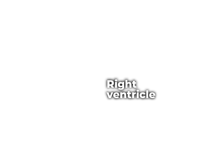 Right ventricle ,Left atrium,Left ventricle ,Aorta
