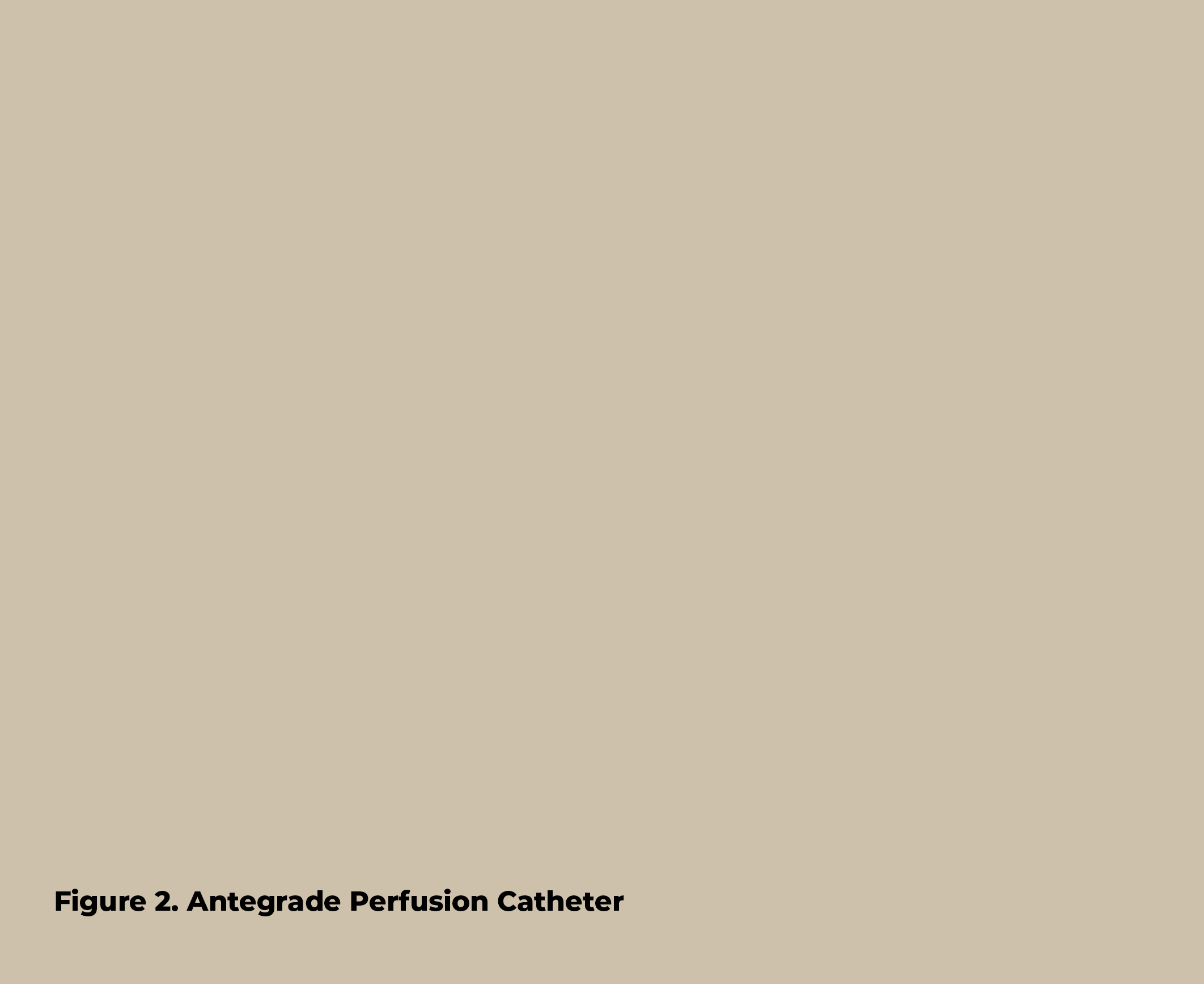 Figure 2  Antegrade Perfusion Catheter 