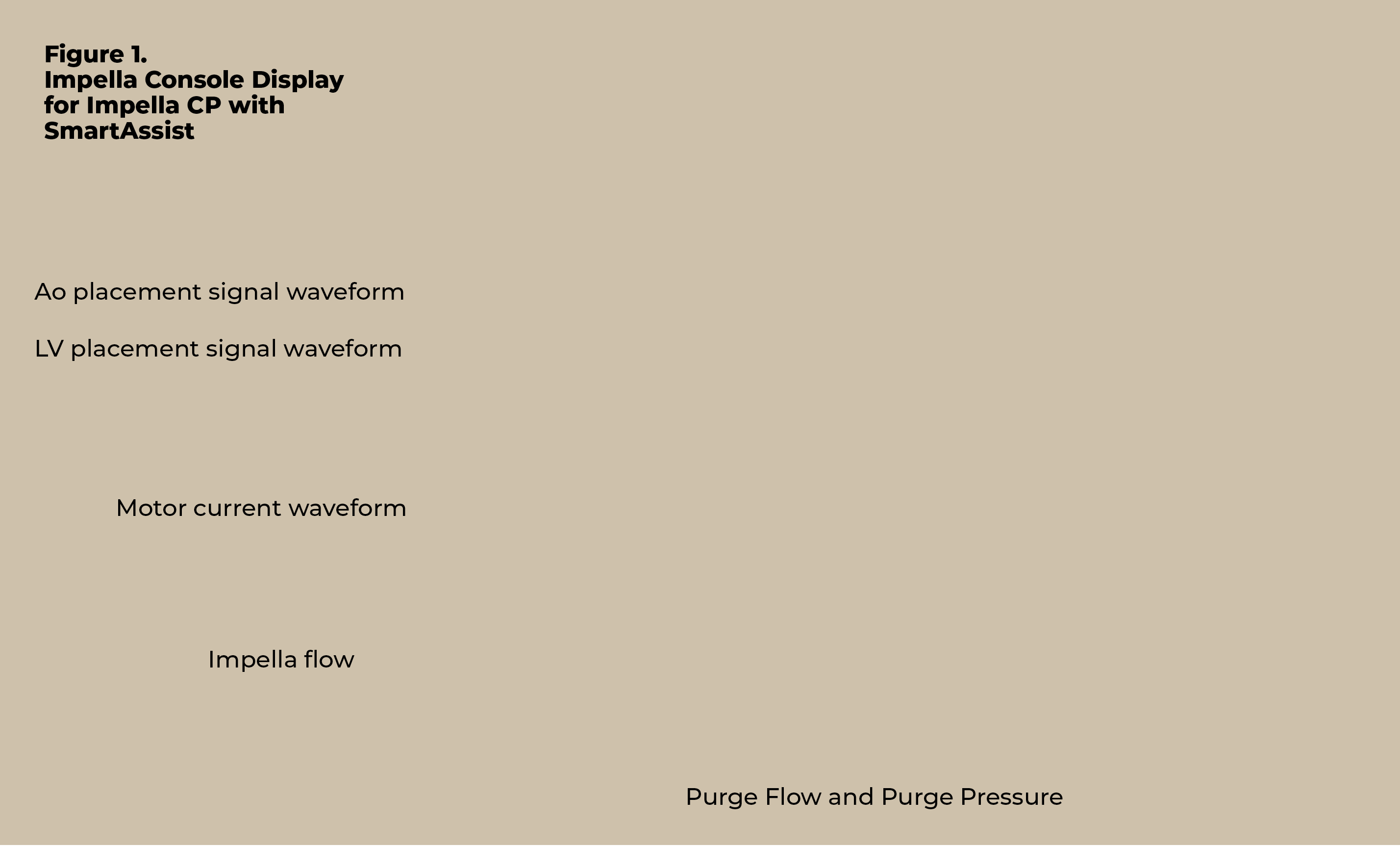 Purge Flow and Purge Pressure ,Impella flow ,Motor current waveform ,LV placement signal waveform ,Ao placement signa   