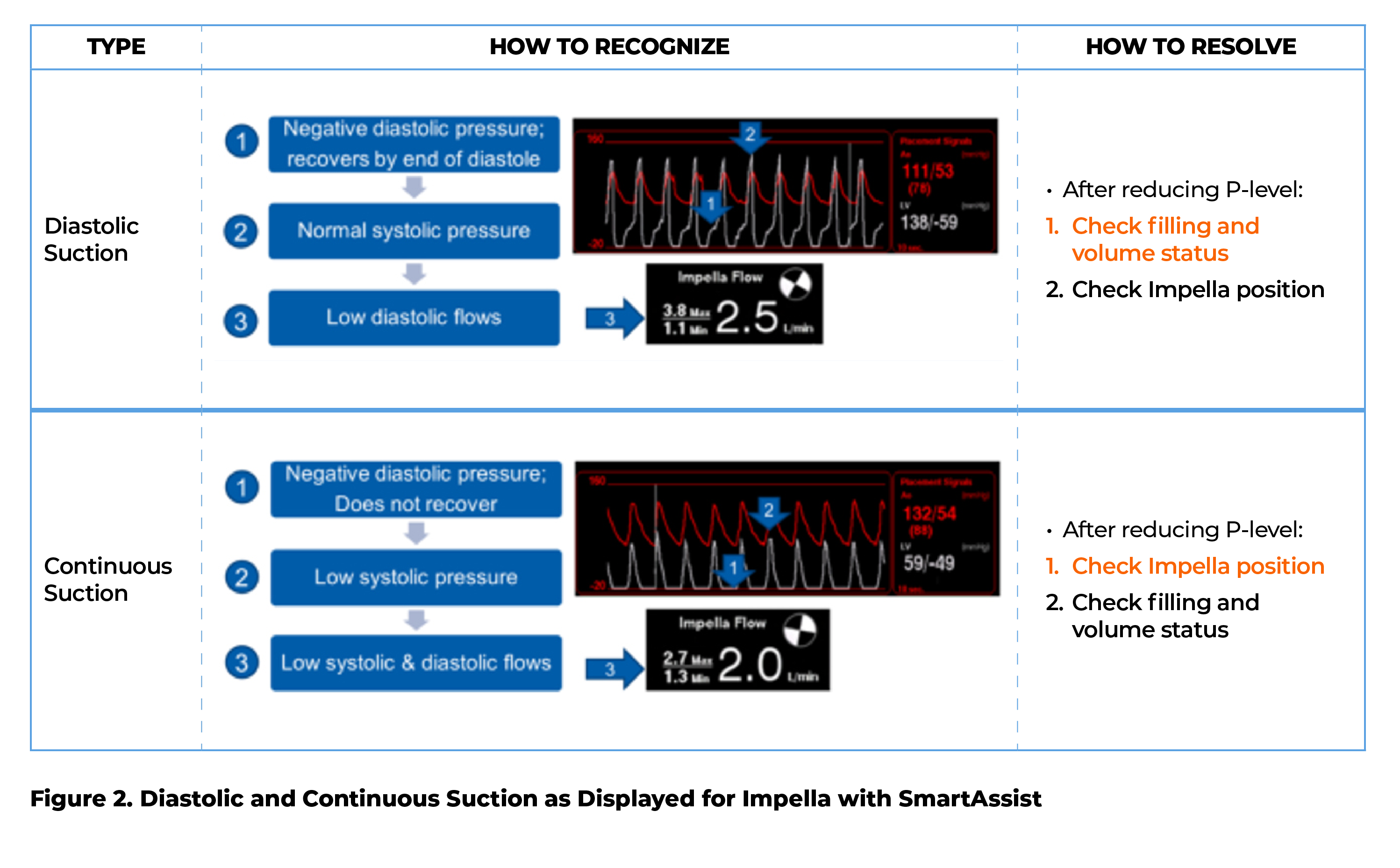   Figure 2  Diastolic and Continuous Suction as Displayed for Impella with SmartAssist 