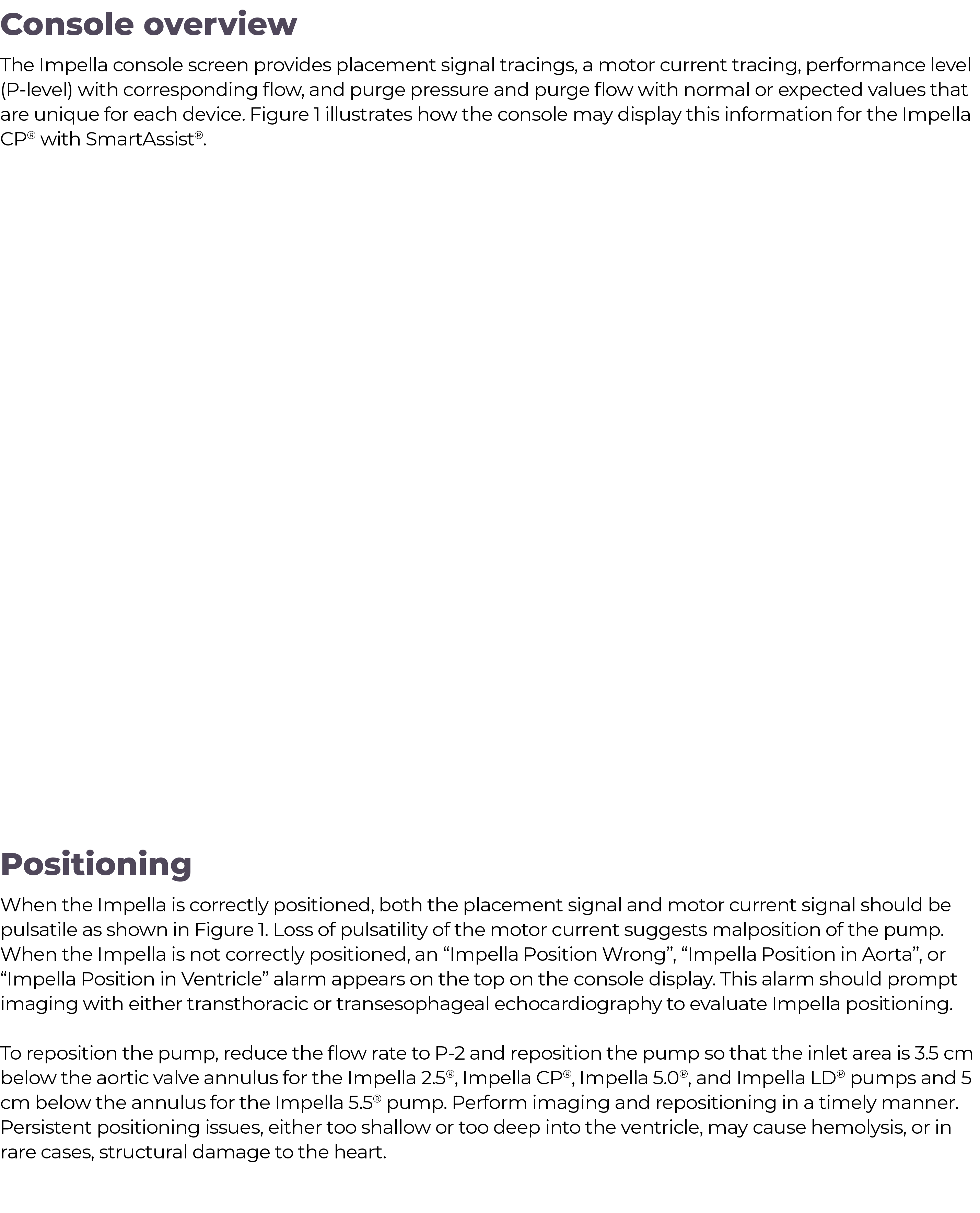 Positioning When the Impella is correctly positioned, both the placement signal and motor current signal should be pu   